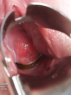 exclusive kate  pics