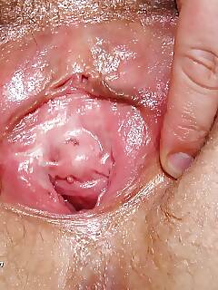 head nurse radka pics